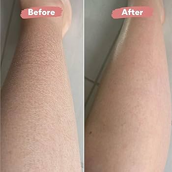 Radiance Renew Exfoliating Glove™